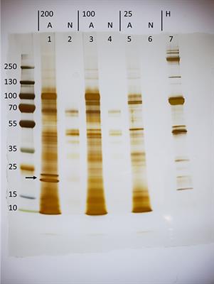 Heterorhabditis bacteriophora Excreted-Secreted Products Enable Infection by Photorhabdus luminescens Through Suppression of the Imd Pathway